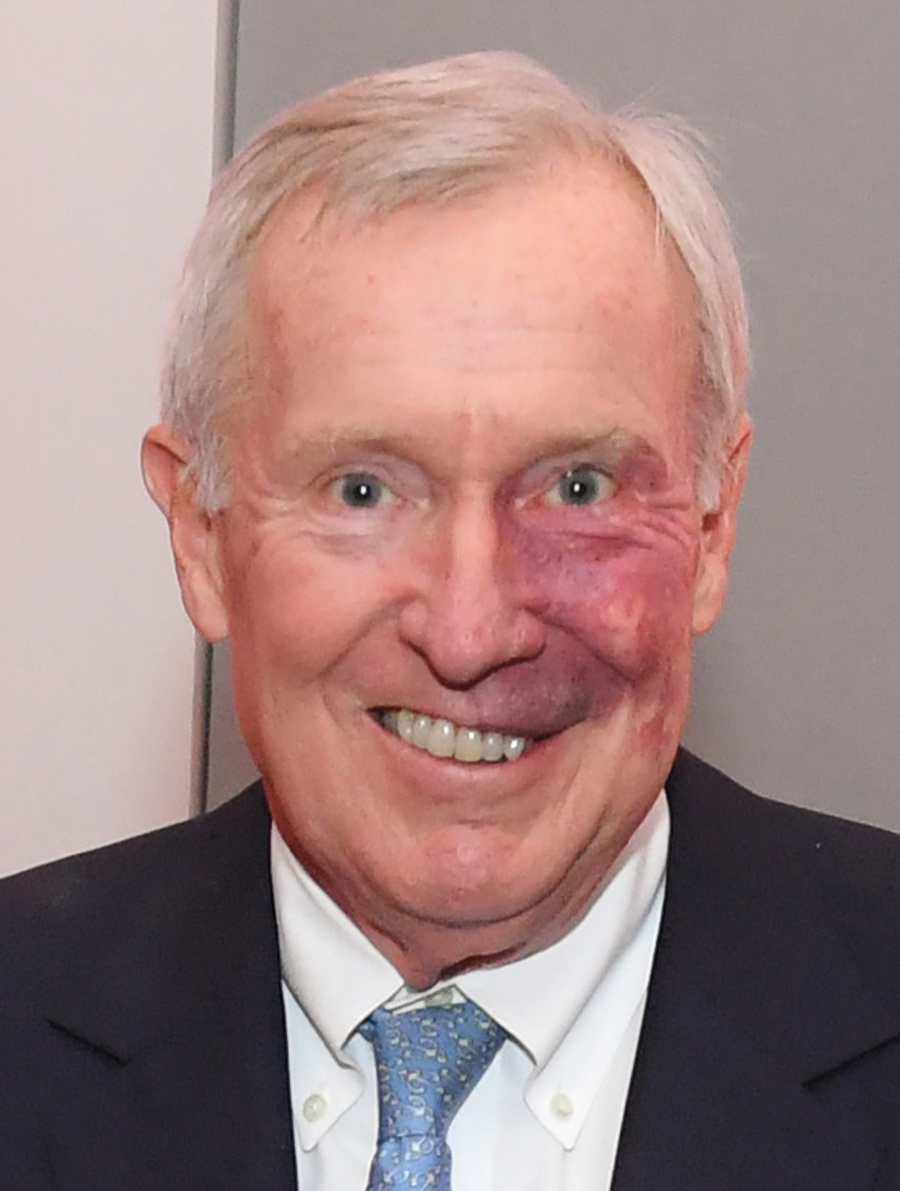 A portrait headshot photograph of Conrad "Connie" Voldstead smiling in a black business suit with a white button-up dress shirt and multi-colored style tie (dark blue and white) as part of his left eye temple area plus cheek is slightly burned resembling a scar
